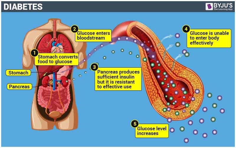 How can Telemedicine be applied in the management of Diabetes in Kenya