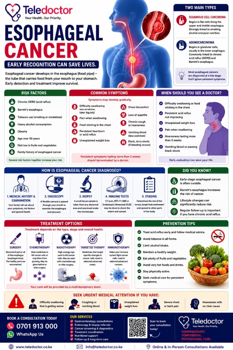 Esophageal Cancer: Symptoms, Risk Factors, Diagnosis, Treatment, and Prevention
